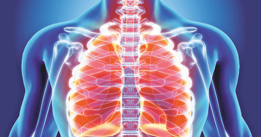 Bronchitis